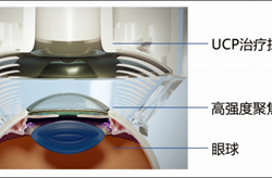 30岁小伙罹患青光眼险失明，爱尔眼科成功挽救双眼