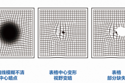 你知道吗？眼底健康我们在家就可以测！