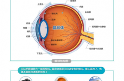 想不到！老花眼减轻竟然不是好事