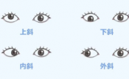 孩子斜视只会影响美观？其实不止！